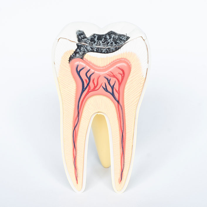 Cavity Detection System